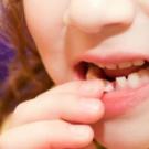 Как без боли вырвать молочный зуб в домашних условиях﻿