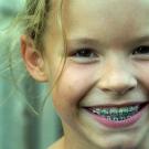 Курс к ровным зубам: когда и как ставят брекеты детям?