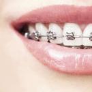 Cara Terbaik Memutihkan Gigi di Rumah Obat Pemutih Gigi Buatan Rumah Terbaik