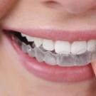 What is the name of the gap between the front teeth?
