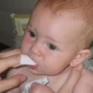 Какво е млечница в устата при новородени и как да се лекува
