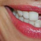 Didelis tarpas tarp dantų: ar tai pavojinga ir kaip jį pašalinti?