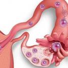 Symptoms and signs of embryo implantation